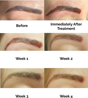Week 4